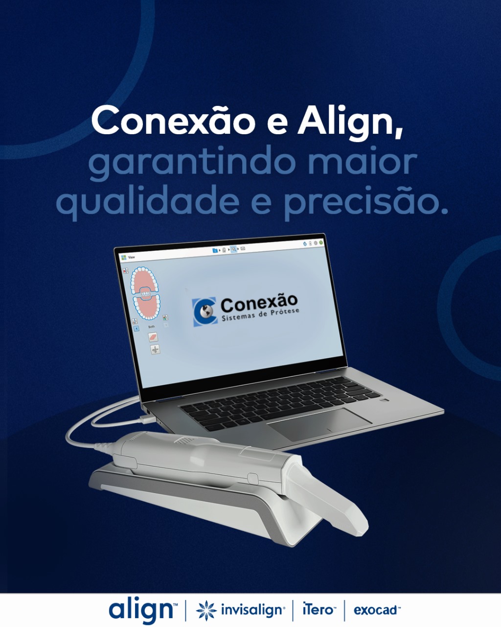 Align iTero (Invisalign) - Image 2