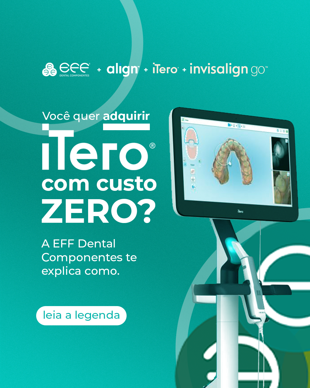 Align iTero (Invisalign) - Image 4