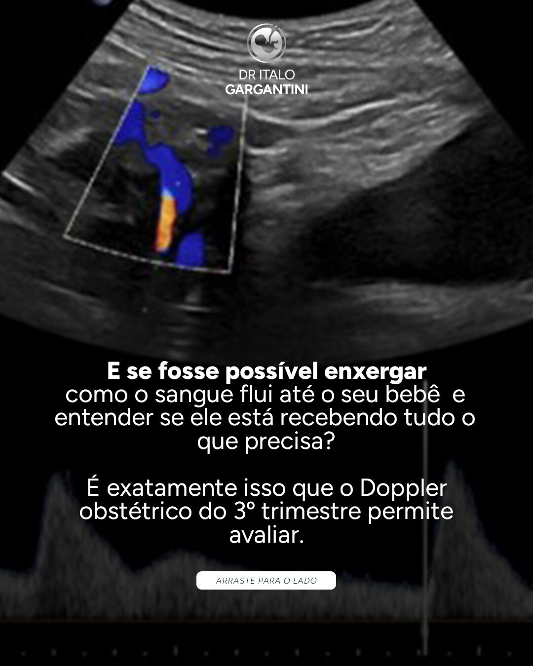 Dr. Italo Gargantini: peça 4 do marketing para Medicina Fetal