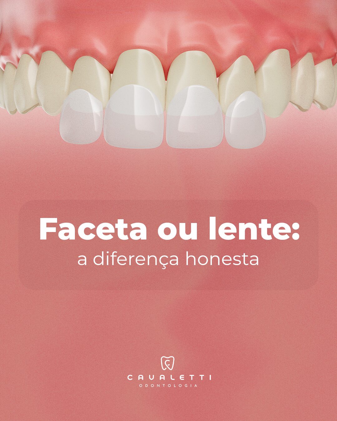 Cavaletti Odontologia: peça 3 do marketing para Dentistas
